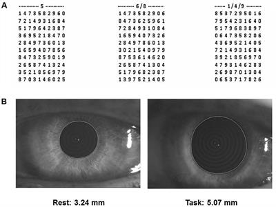 Short-Term Effects of Chewing on Task Performance and Task-Induced Mydriasis: Trigeminal Influence on the Arousal Systems